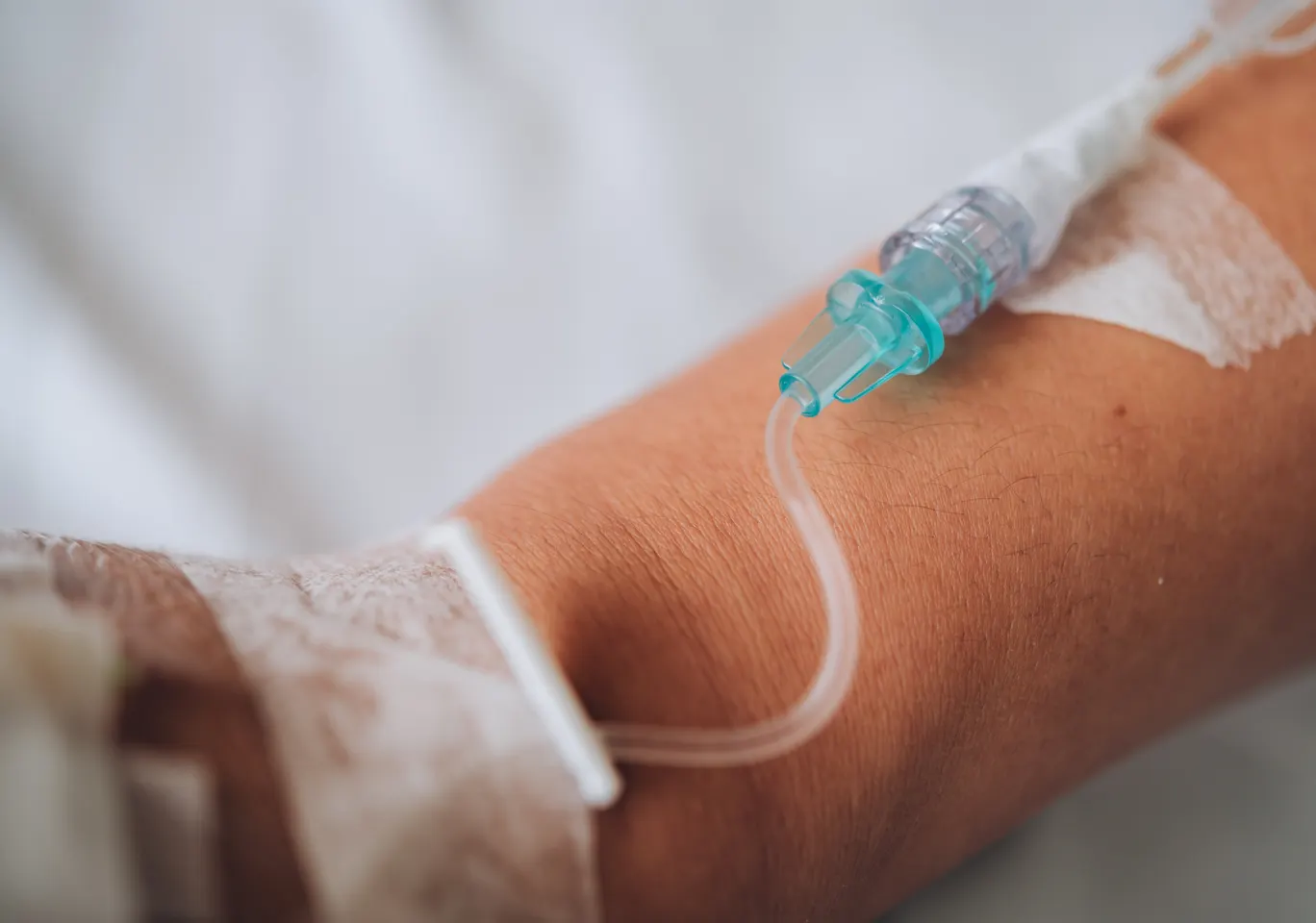 Kroplówki witaminowe Siedlce: wenflon oklejony na przedramieniu podczas wlewu